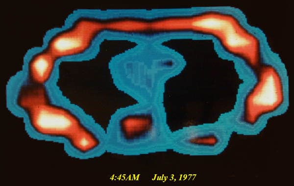 The first ever MRI scan of a live human being