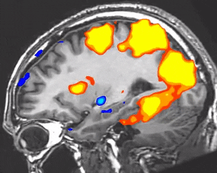 An fMRI scan